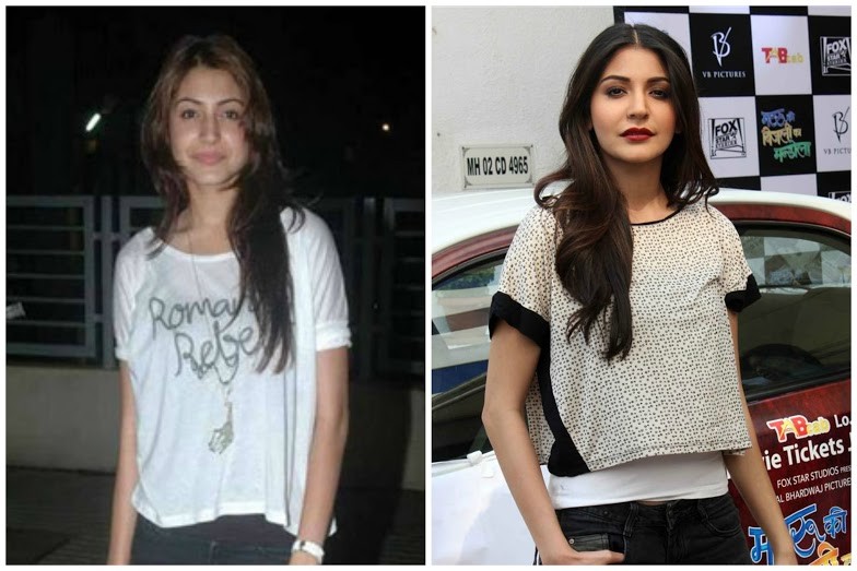 Anushka Sharma