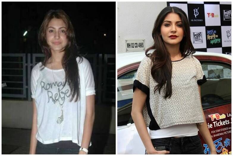 Anushka Sharma