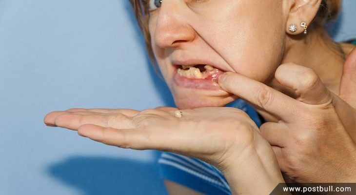 Teeth
