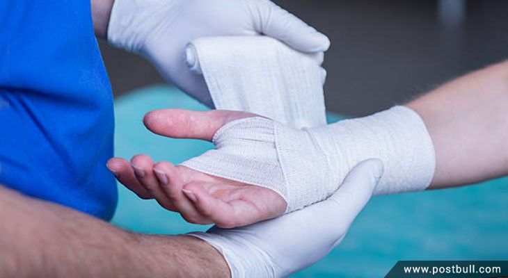 Fracture