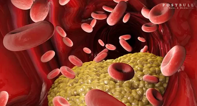 Lower Blood Cholesterol